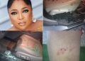 Kemi Afolabi Attacked by Robbers