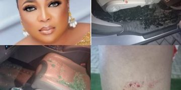 Kemi Afolabi Attacked by Robbers