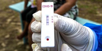 Lagos Government Reduces Price OF COVID-19 PCR Test
