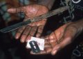 House of Reps Calls for Sensitization on Female Genital Mutilation