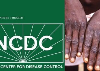 NCDC Confirms 21 Cases of Monkeypox
