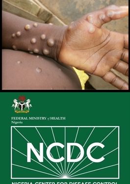 NCDC Urges Nigerians to Take Measures Against Monkey Pox