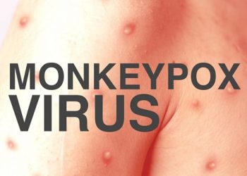 Kwara Confirms First Case of Monkey pox
