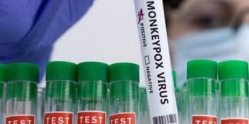 Eight Persons Test Positive for Monkey Pox in Edo