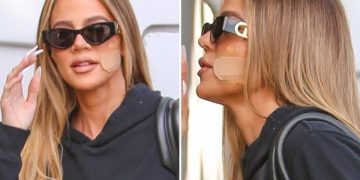 Kardashian Undergoes Surgery to Remove Tumor from Face