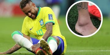Neymar Sustains Ankle Injury