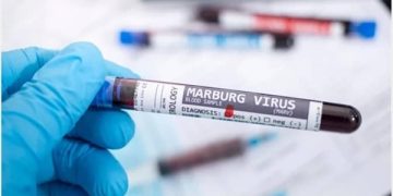 Equatorial Guinea Records New Cases of Marburg Virus